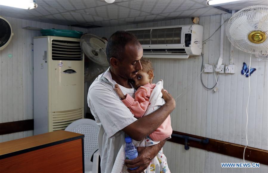 YEMEN-HODEIDAH-PATIENTS 